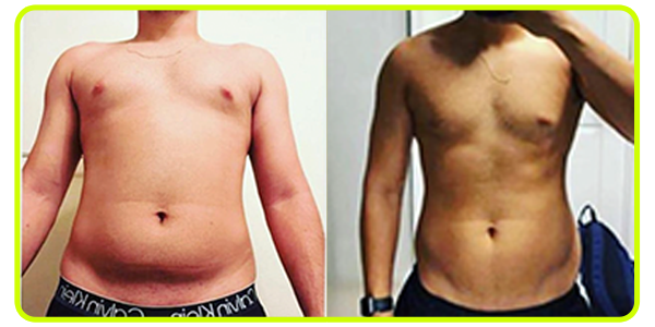 antes 1