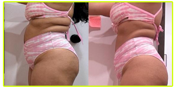 antesdepois7